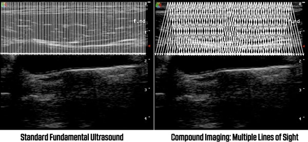 Compound imaging