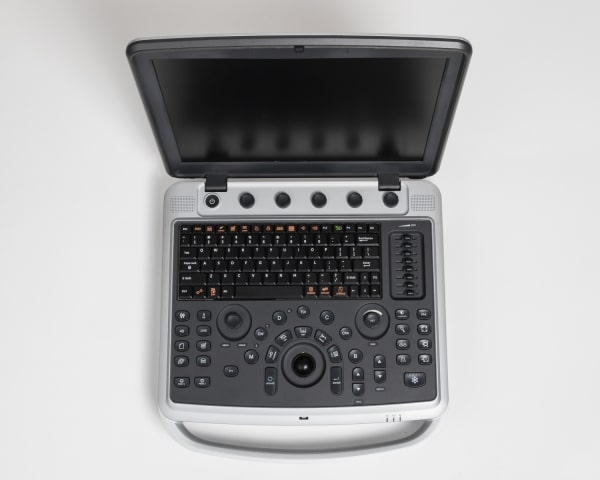 Chison SonoBook 9 top view