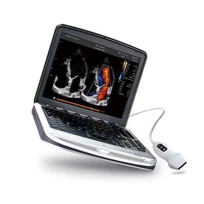 Chison SonoBook 9 for sale