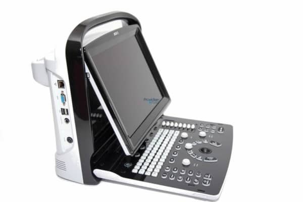 Chison ECO3 Ultrasound