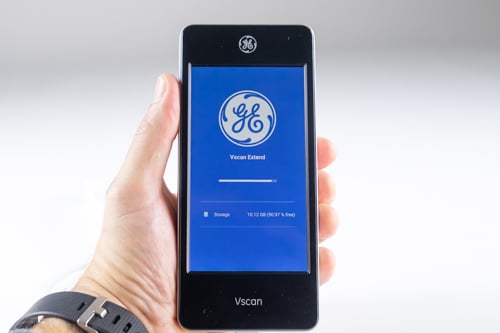 GE VScan Extend close-up view in hand