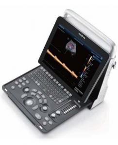 Mindray-Z60-ultrasound