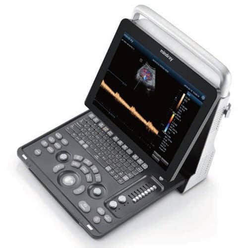 Mindray Z60 ultrasound