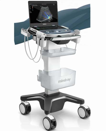 refurbished-Mindray-MX7