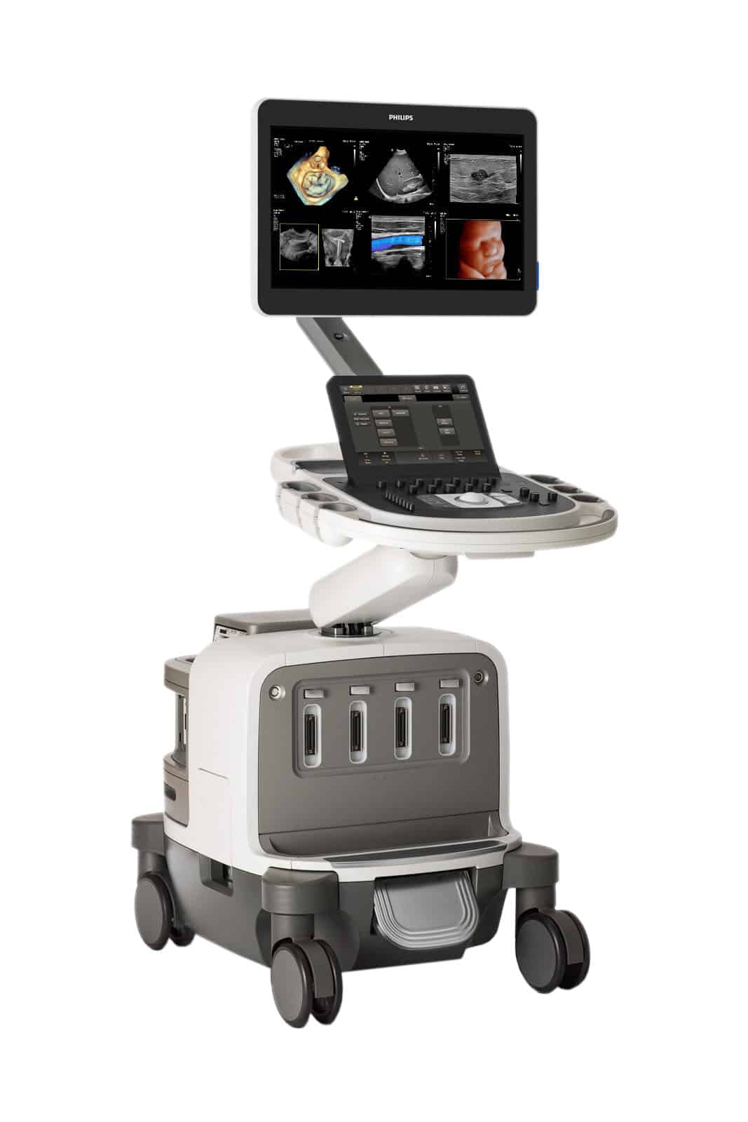The Best Radiology Ultrasound Machines in 2023, A Buyer's Guide Probo