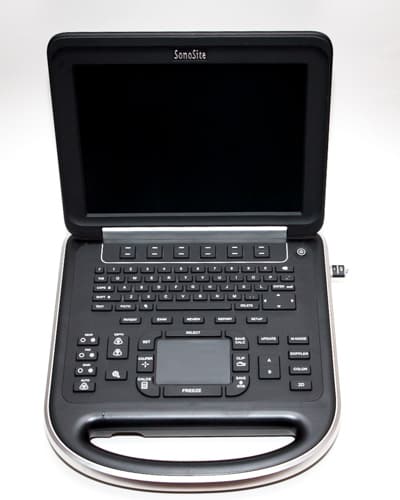 Refurbished Sonosite Edge For Sale