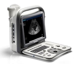 refurbished ultrasound