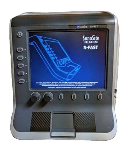 sonosite-s-series-ultrasound-for-sale