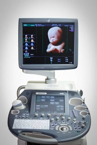 voluson e8 ultrasound