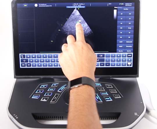 GE Vivid iq ultrasound training screenshot