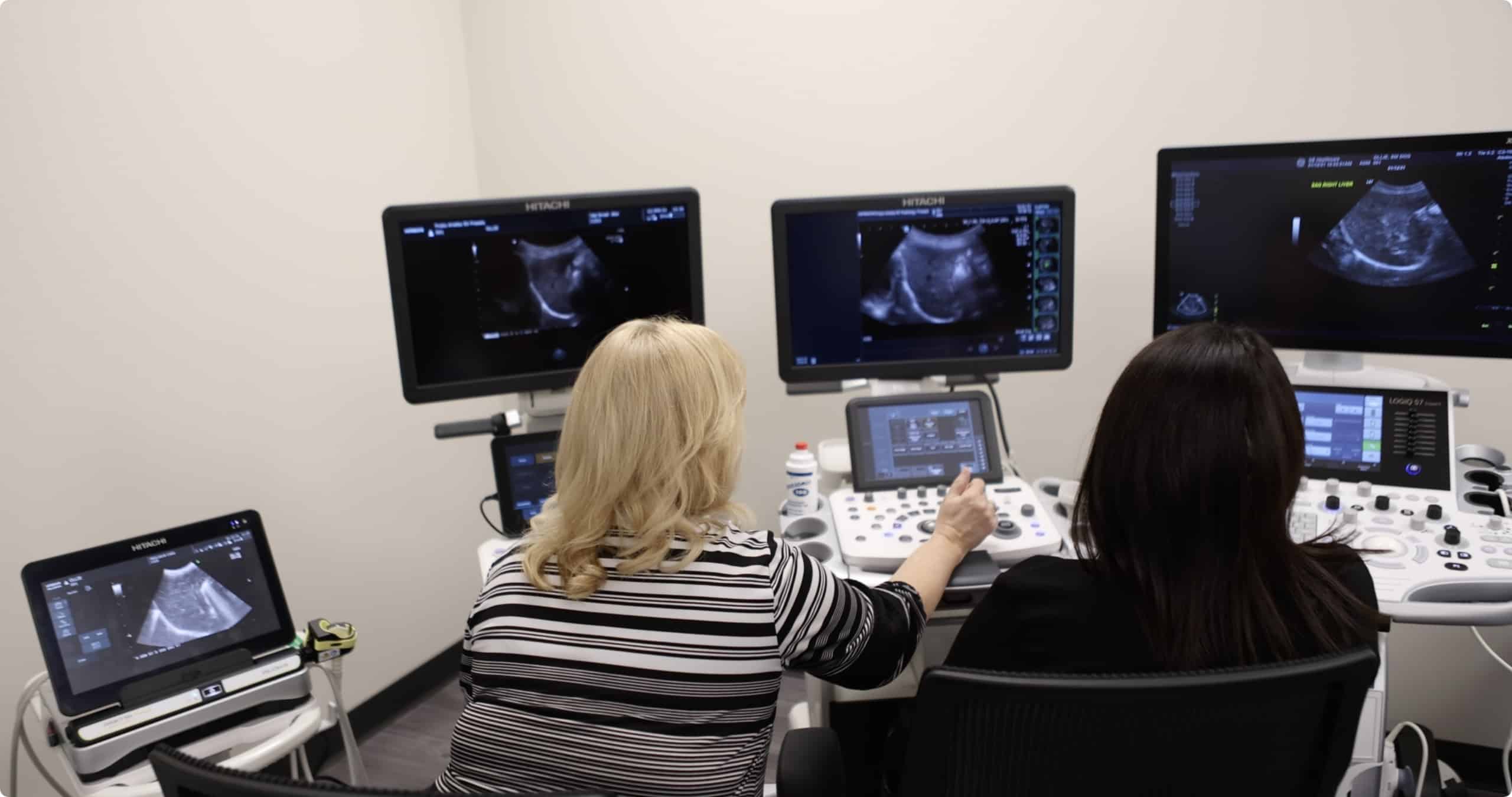 Ultrasound System comparisons by Probo Medical sonographers